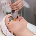 Understanding Pro Yellow Laser: A New Era in Skin Treatment
