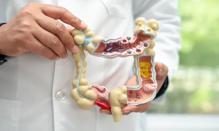 Why Colonoscopy Costs Vary So Much Across Different Institutions