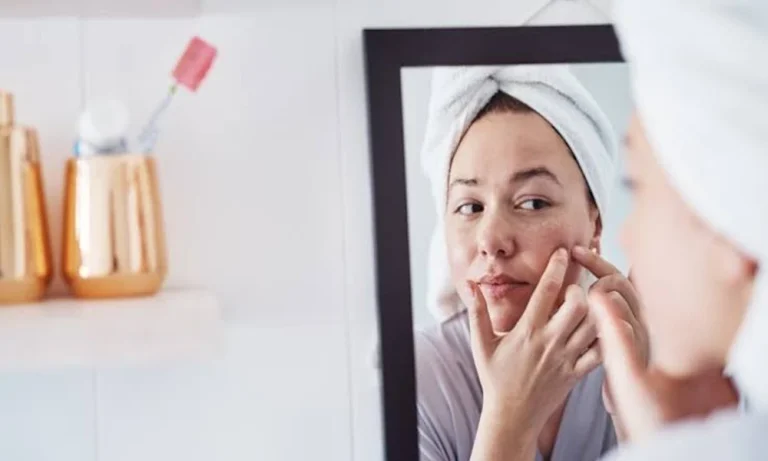 WHAT TO KNOW BEFORE HAVING A SKIN EXAMINATION?